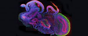 cerebral_brain_organoid